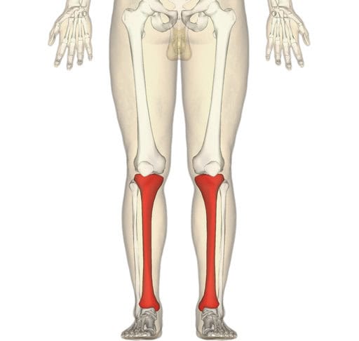 Tibia fracture with surgery Florida hotel accident claim.
