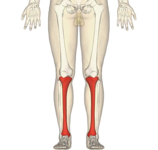 Tibia fracture with surgery Florida hotel accident claim.