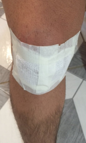 Bandage on knee after surgery.