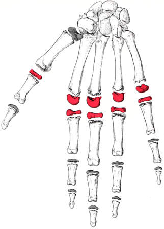 Metacarpal-Phalangeal Joint