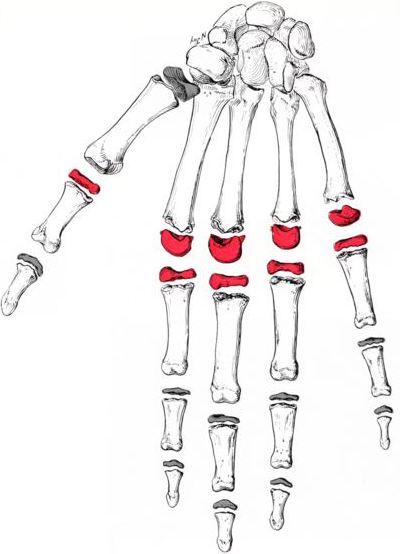 Metacarpalphalangeal joint