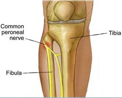 Peroneal nerve