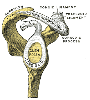 SLAP Tear. Glenoid fossa of right side. (Glenoidal labrum labeled as "glenoid lig.")