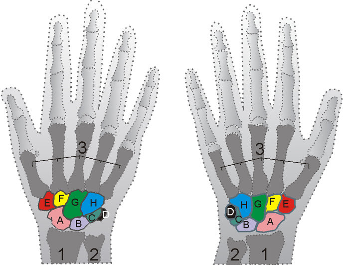 Shown is the right hand, palm down (left) and palm up (right). A=Scaphoid, B=Lunate