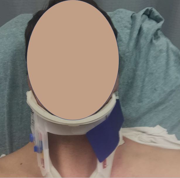 wearing neck brace in hospital bed