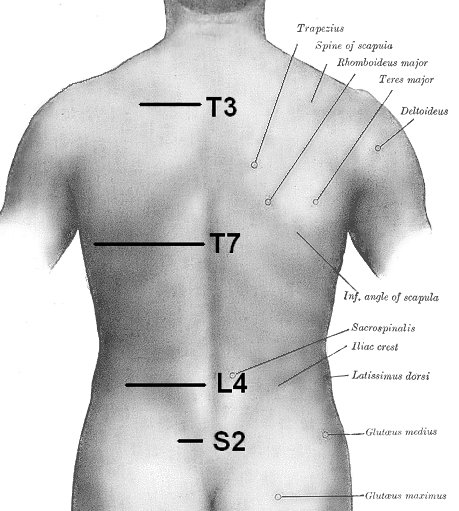 image showing T3 and other vertebrae