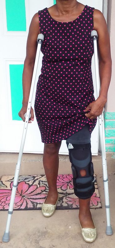 lady on crutches with leg brace for broken leg