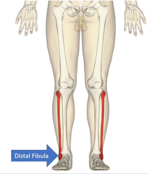 distal fibula (forms the ankle)