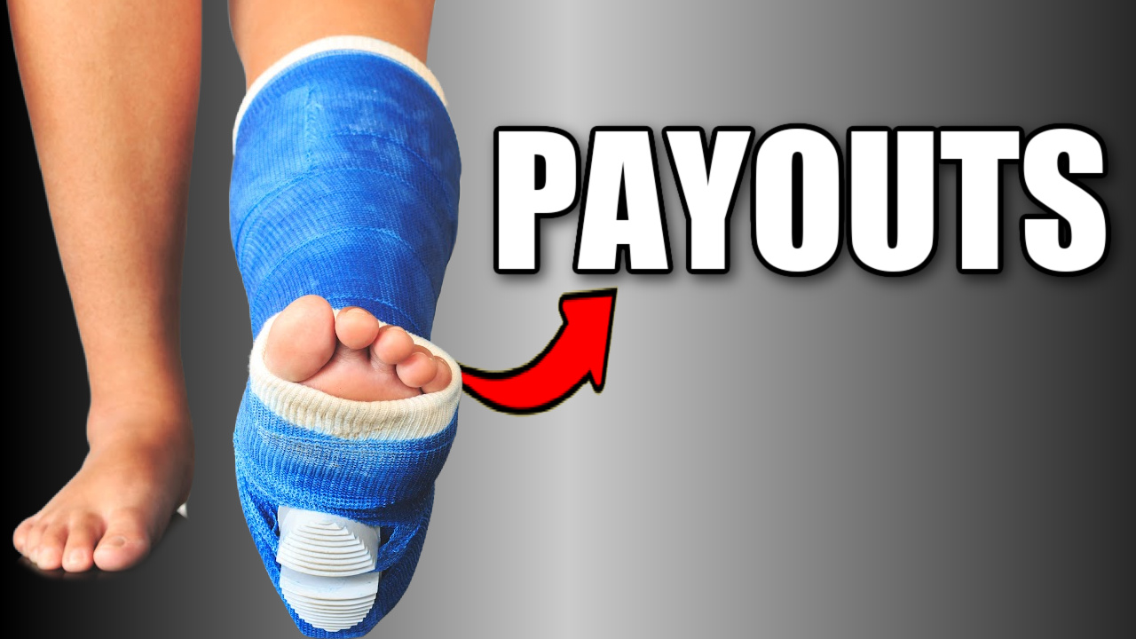 broken ankle in a cast (payouts)
