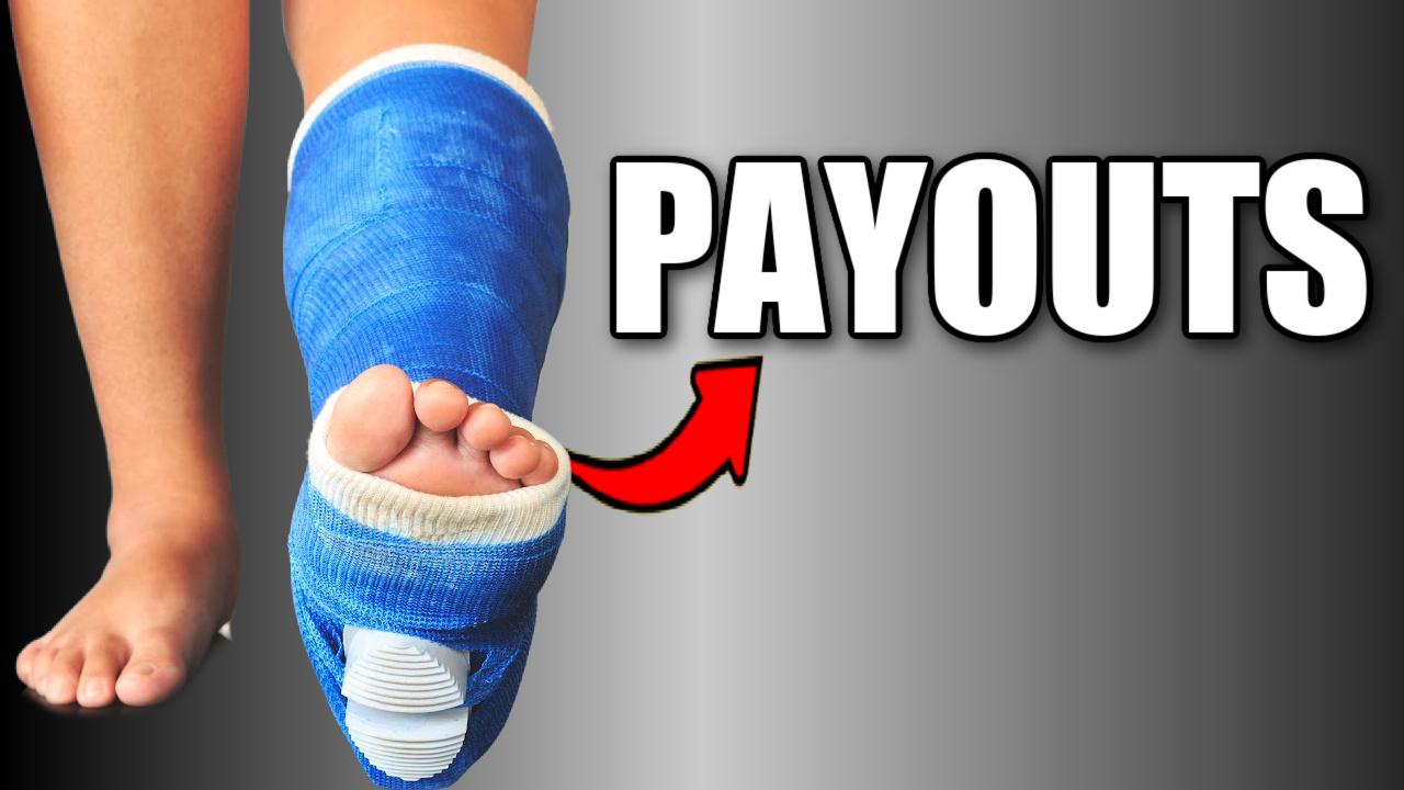 Broken Ankle Settlements (Car Accident Claims, Falls and More)